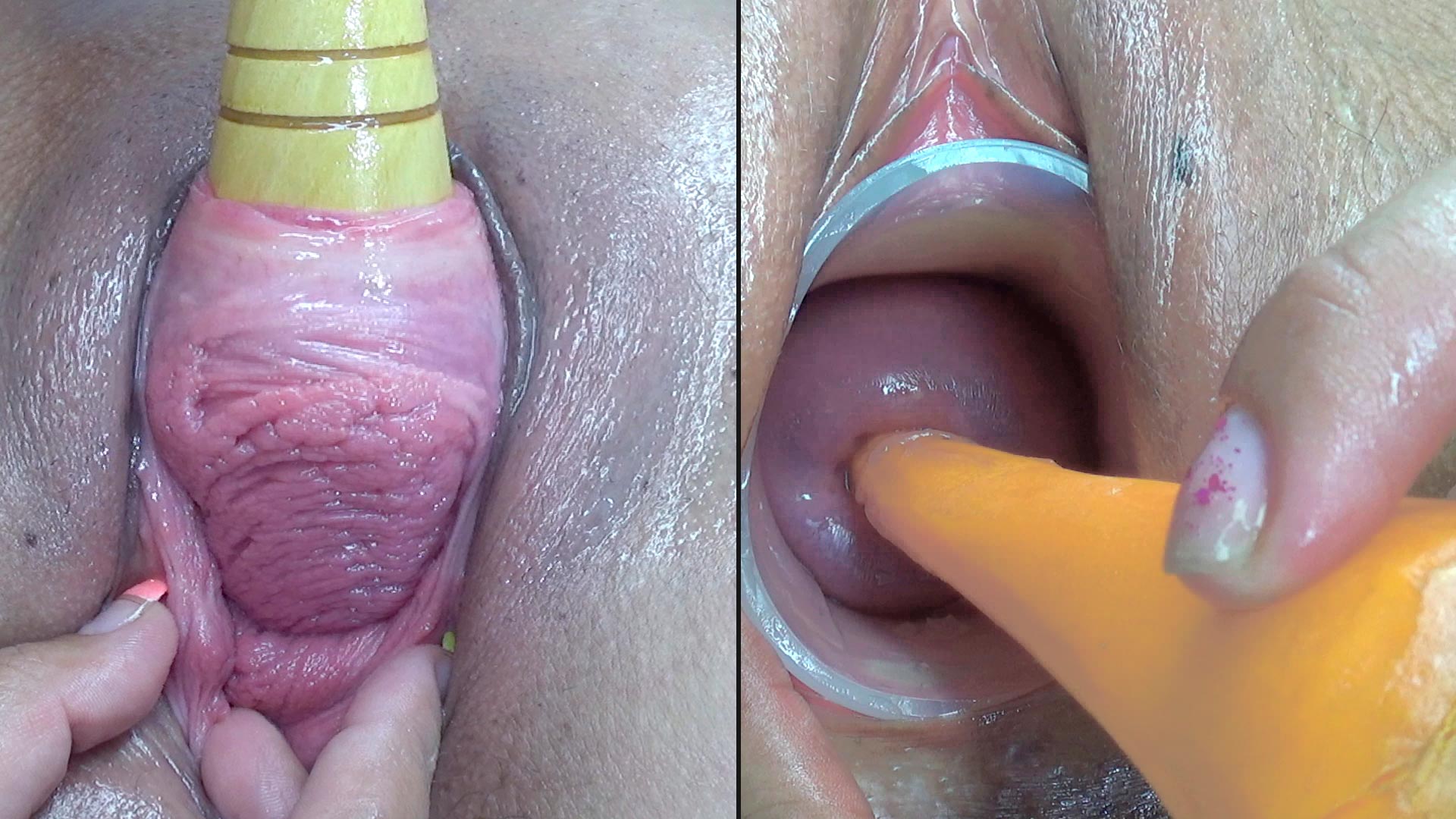 Lesbians Pee Hole Penetration and Cervix Fucking with vegetables -  PervertTube.com